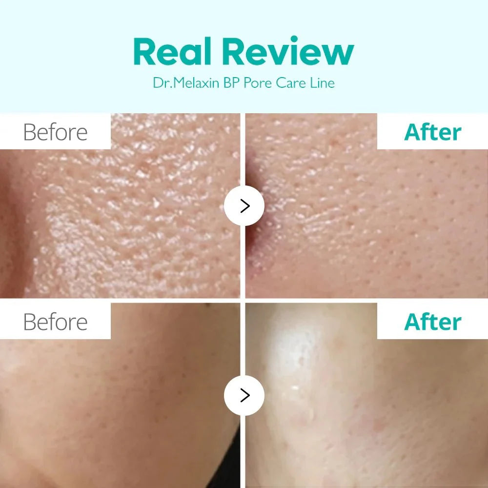 Dr.Melaxin BP Pore Barrier Cream 50g