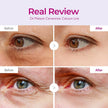 Dr.Melaxin Cemenrete Calcium Dark Spot Eye Cream 15g