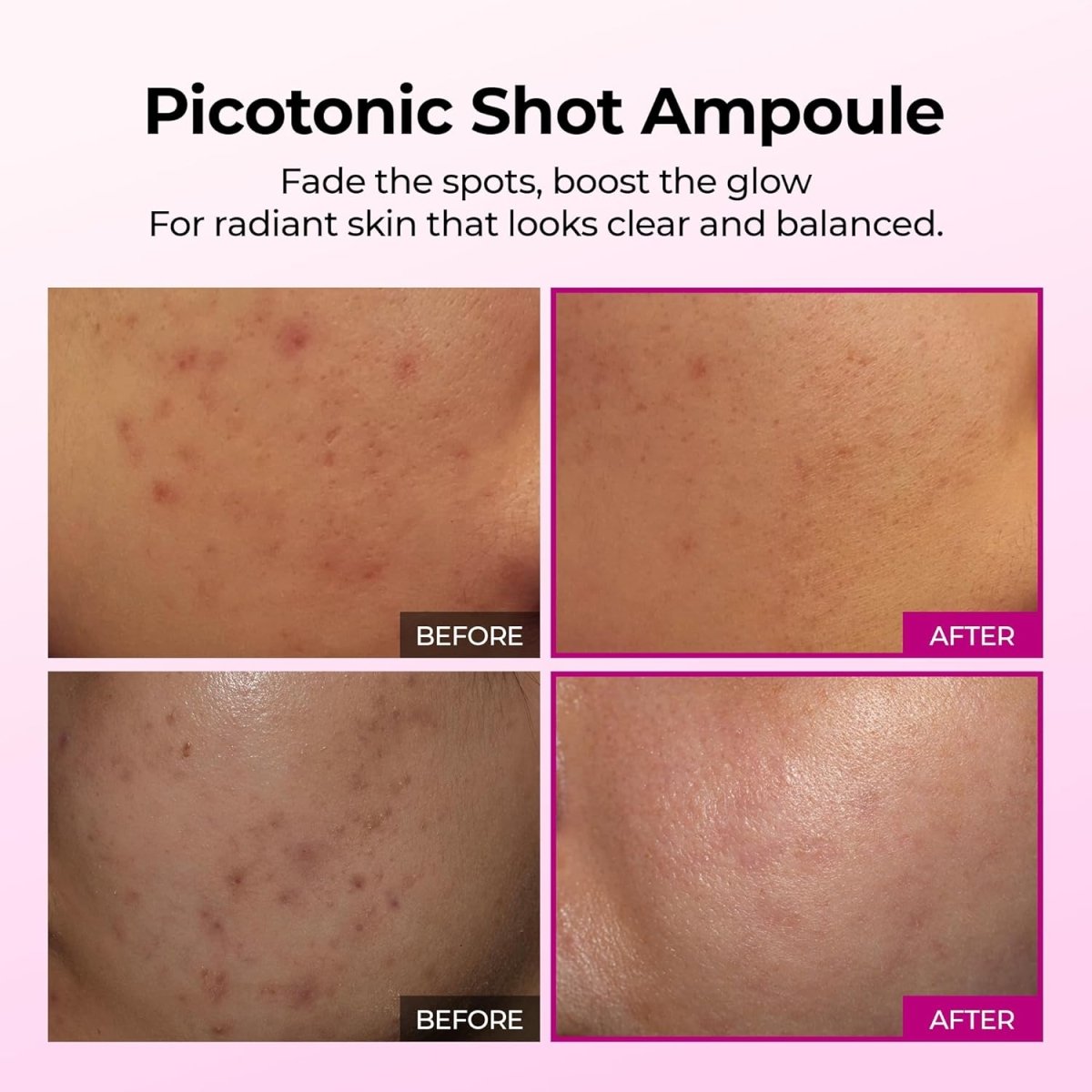 Dr.Melaxin Cemenrete Picotonic Shot Ampoule 30ml
