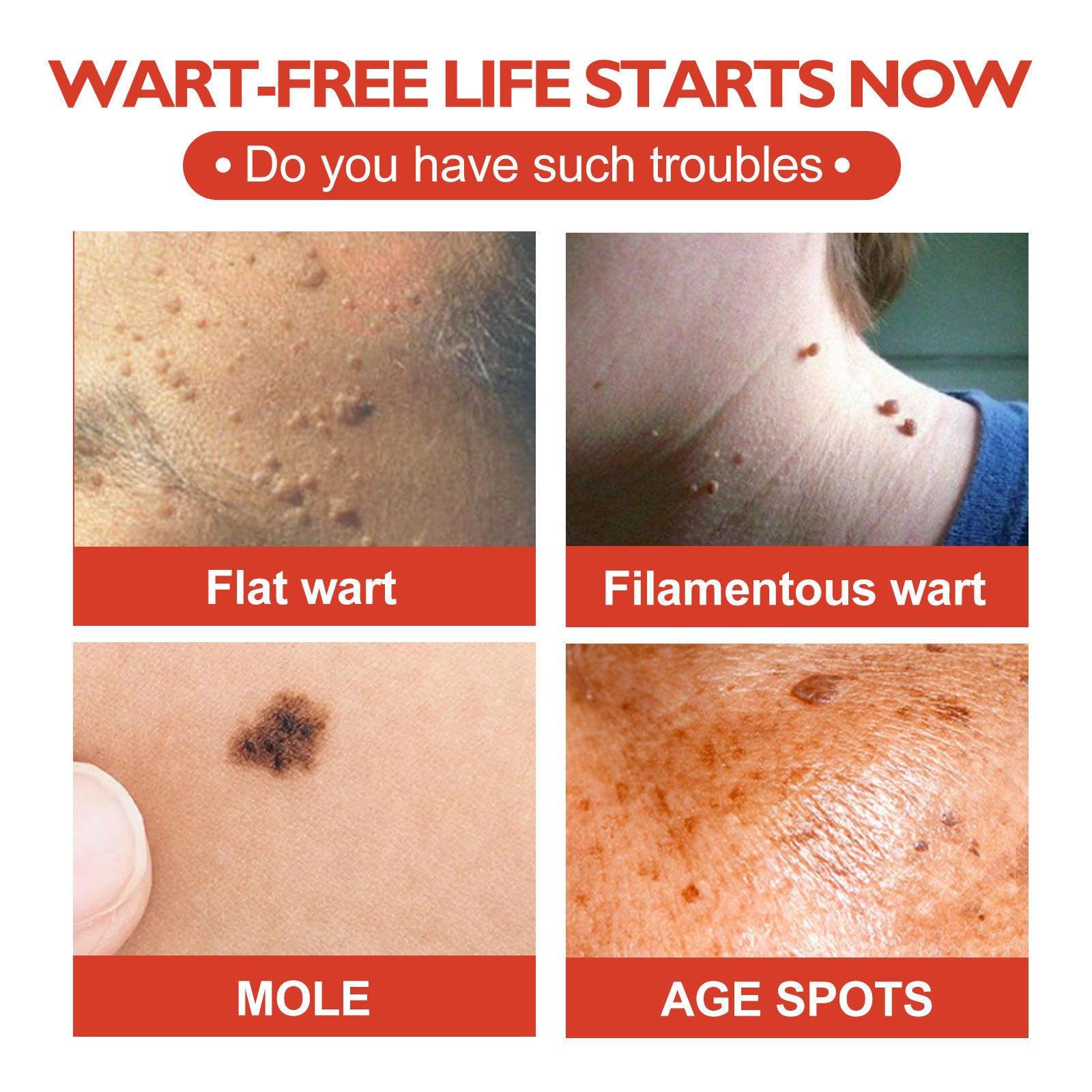 Micro Dart Skin Tag Remover Patches – Invisible Wart & Blemish Spot Treatment