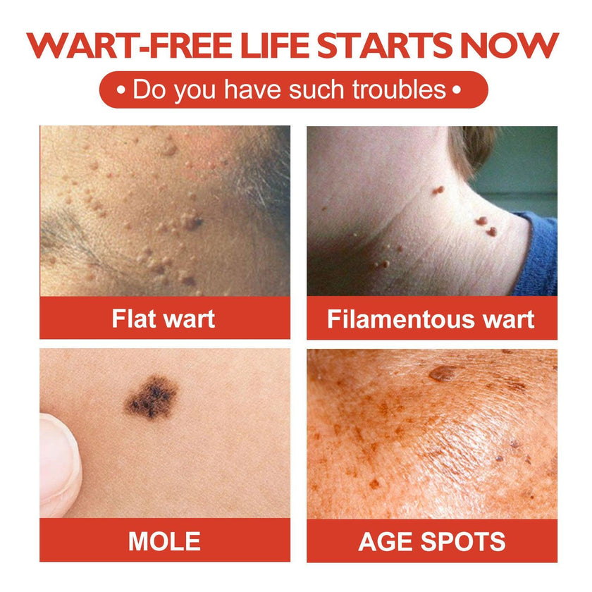 Micro Dart Skin Tag Remover Patches – Invisible Wart & Blemish Spot Treatment