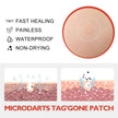 Micro Dart Skin Tag Remover Patches – Invisible Wart & Blemish Spot Treatment