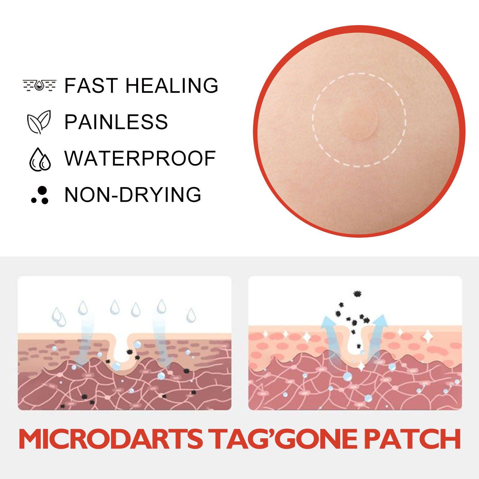 Micro Dart Skin Tag Remover Patches – Invisible Wart & Blemish Spot Treatment