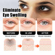 Snake Venom Eye Cream Kojic Acid Coffee Seed Extract Hyaluronic Acid Dark Circles Wrinkles Tightening
