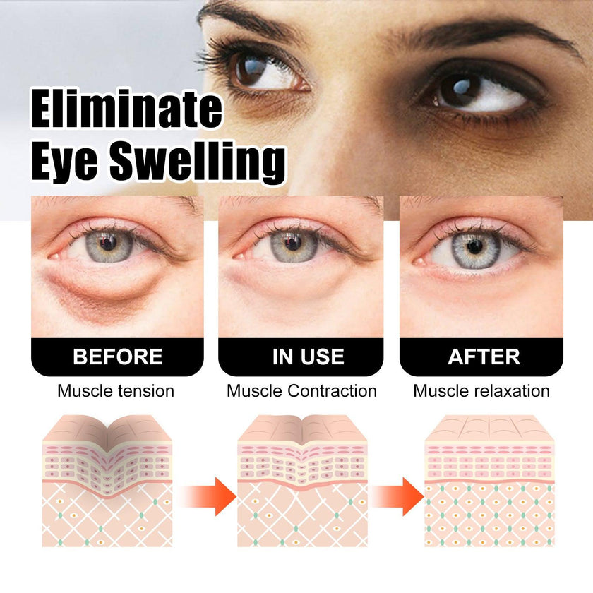 Snake Venom Eye Cream Kojic Acid Coffee Seed Extract Hyaluronic Acid Dark Circles Wrinkles Tightening
