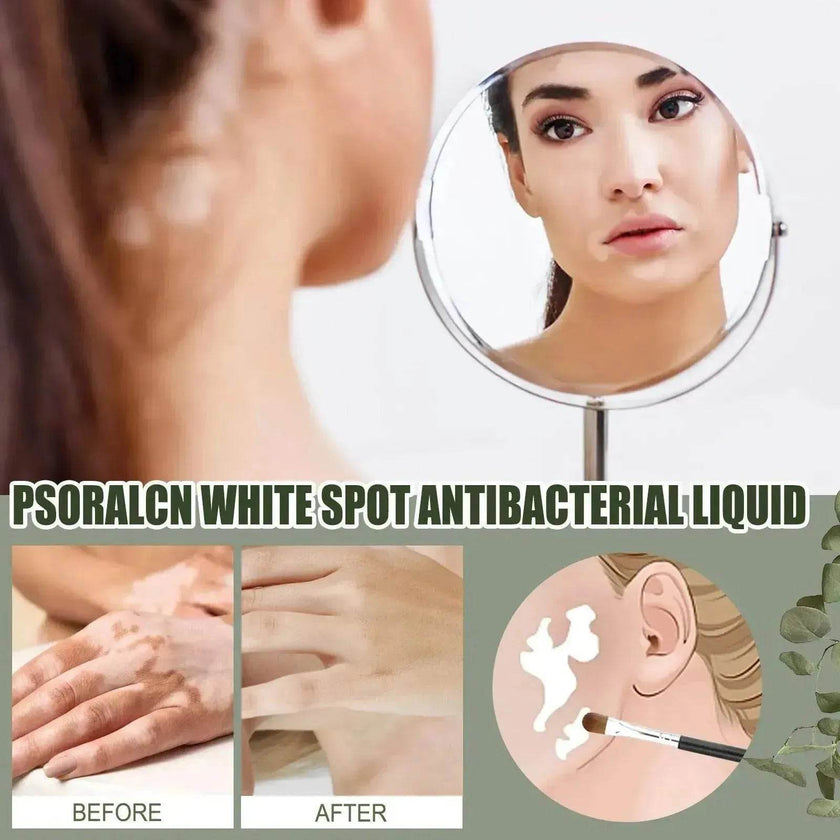 EELHOE White Spot Cleansing Serum  PSORALCN White Spot Antibacterial Liquid.