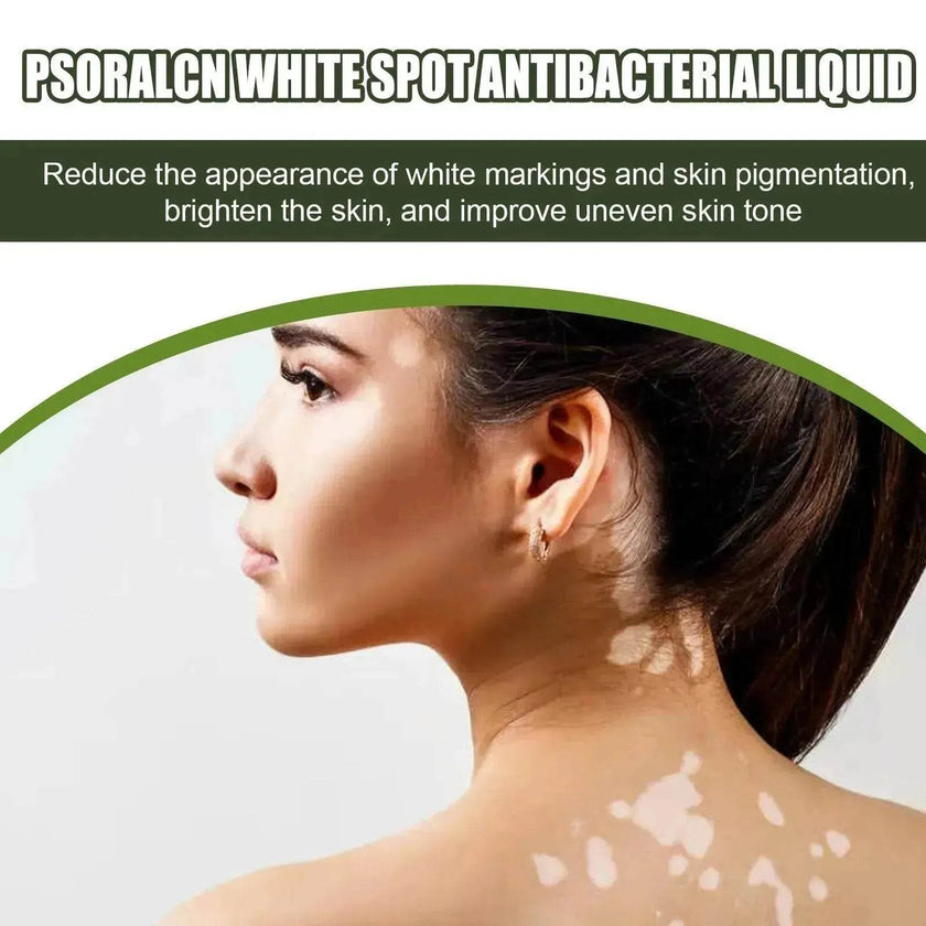 EELHOE White Spot Cleansing Serum  PSORALCN White Spot Antibacterial Liquid.