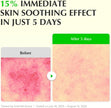 Eqqualberry Aloe PDRN Calming Serum 30ml