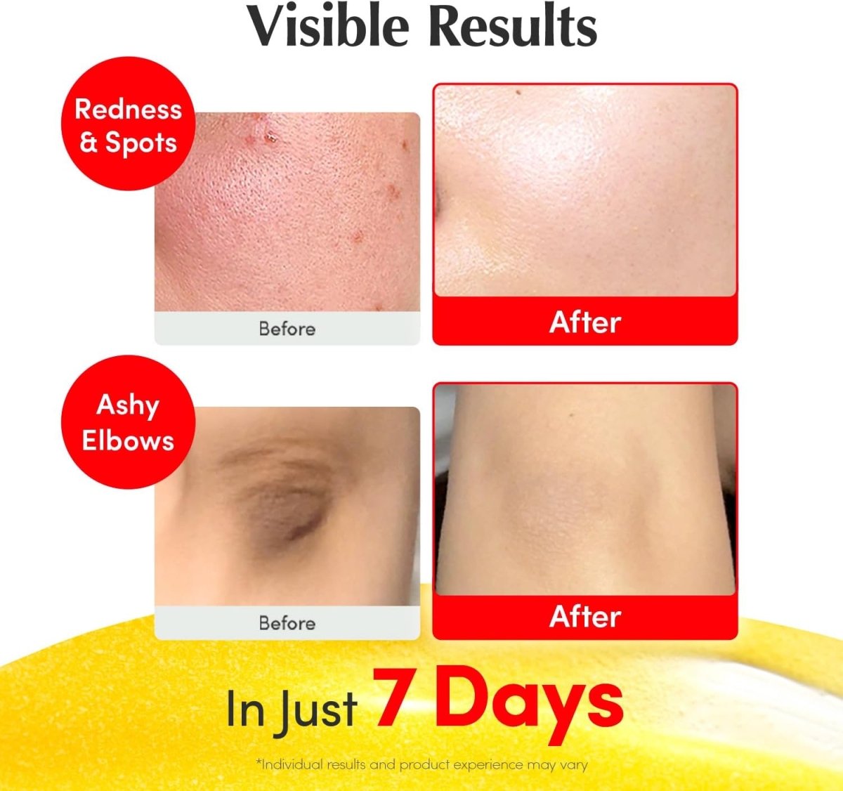 Eqqualberry Vitamin Illuminating Serum 30ml