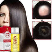 Hair Growth Oil – Anti Hair Loss Scalp Treatment Oil for Thicker, Stronger & Shinier Hair