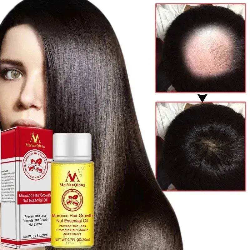Hair Growth Oil – Anti Hair Loss Scalp Treatment Oil for Thicker, Stronger & Shinier Hair
