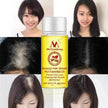 Hair Growth Oil – Anti Hair Loss Scalp Treatment Oil for Thicker, Stronger & Shinier Hair
