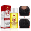 Hair Growth Oil – Anti Hair Loss Scalp Treatment Oil for Thicker, Stronger & Shinier Hair