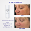 iS Clinical Brightening Complex