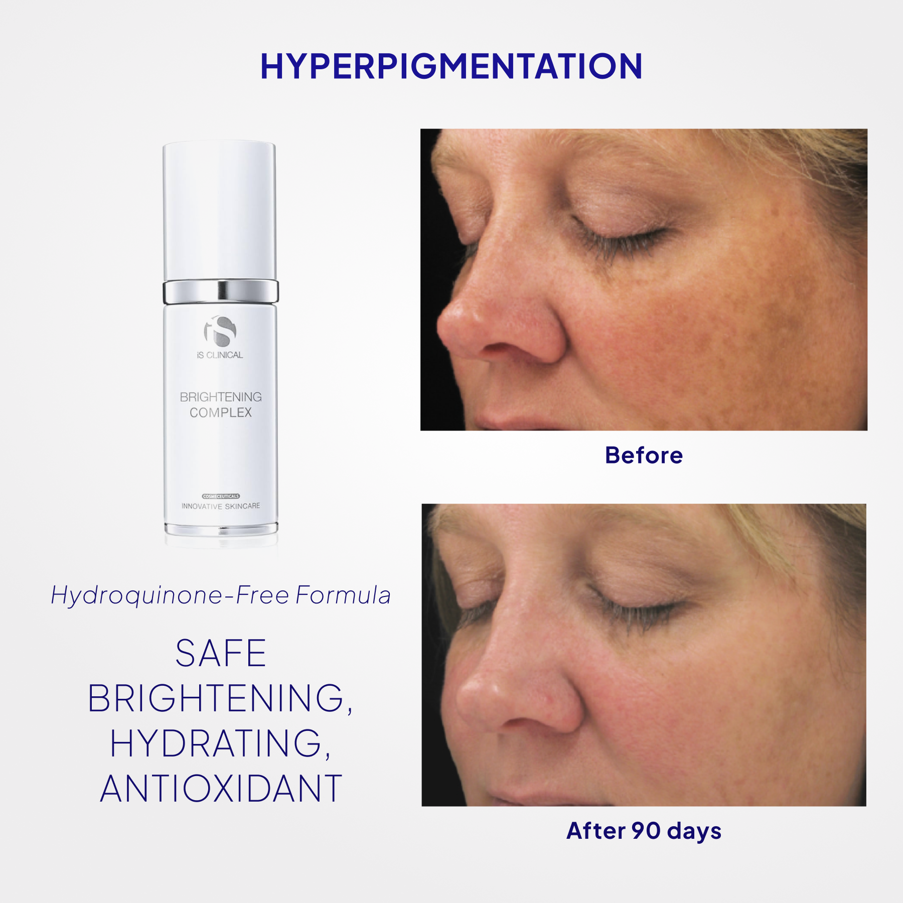 iS Clinical Brightening Complex