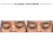 iS Clinical Youth Serum
