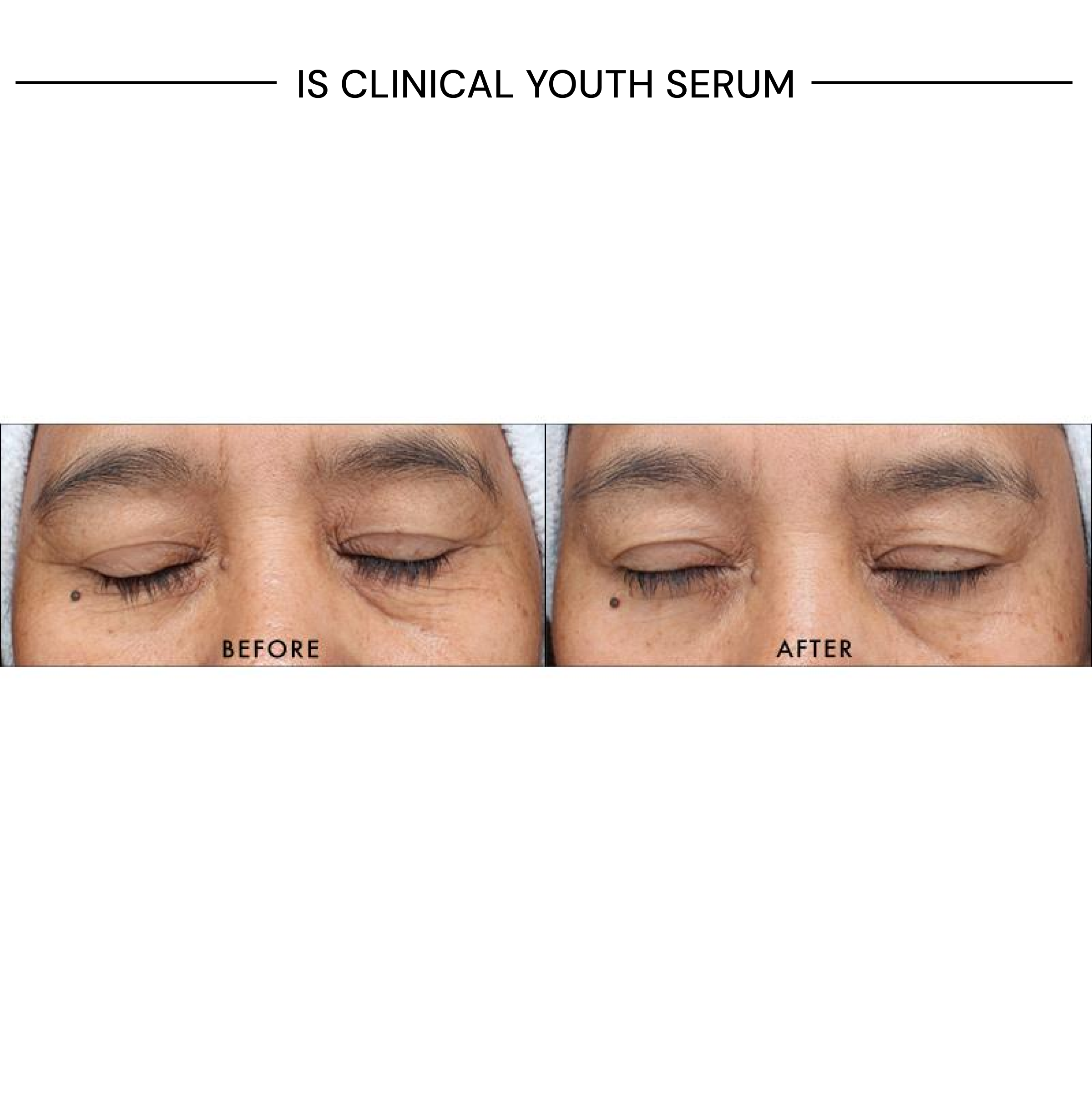 iS Clinical Youth Serum