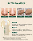 KSECRET SEOUL 1988 Cleansing Oil: Pine Cica 1% + Probiotics 200ml