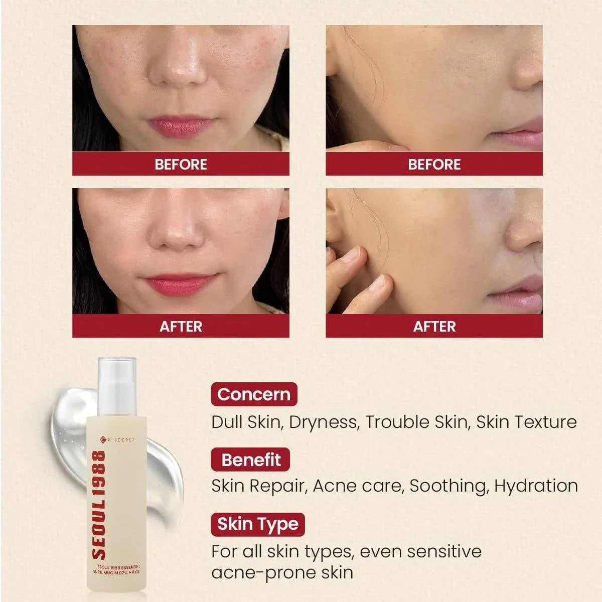 KSECRET SEOUL 1988 Essence: Snail Mucin 97% + Rice 100ml