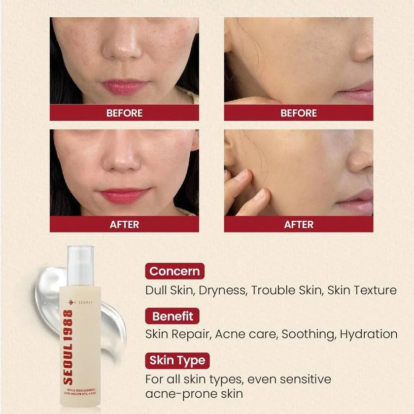 KSECRET SEOUL 1988 Essence: Snail Mucin 97% + Rice 100ml