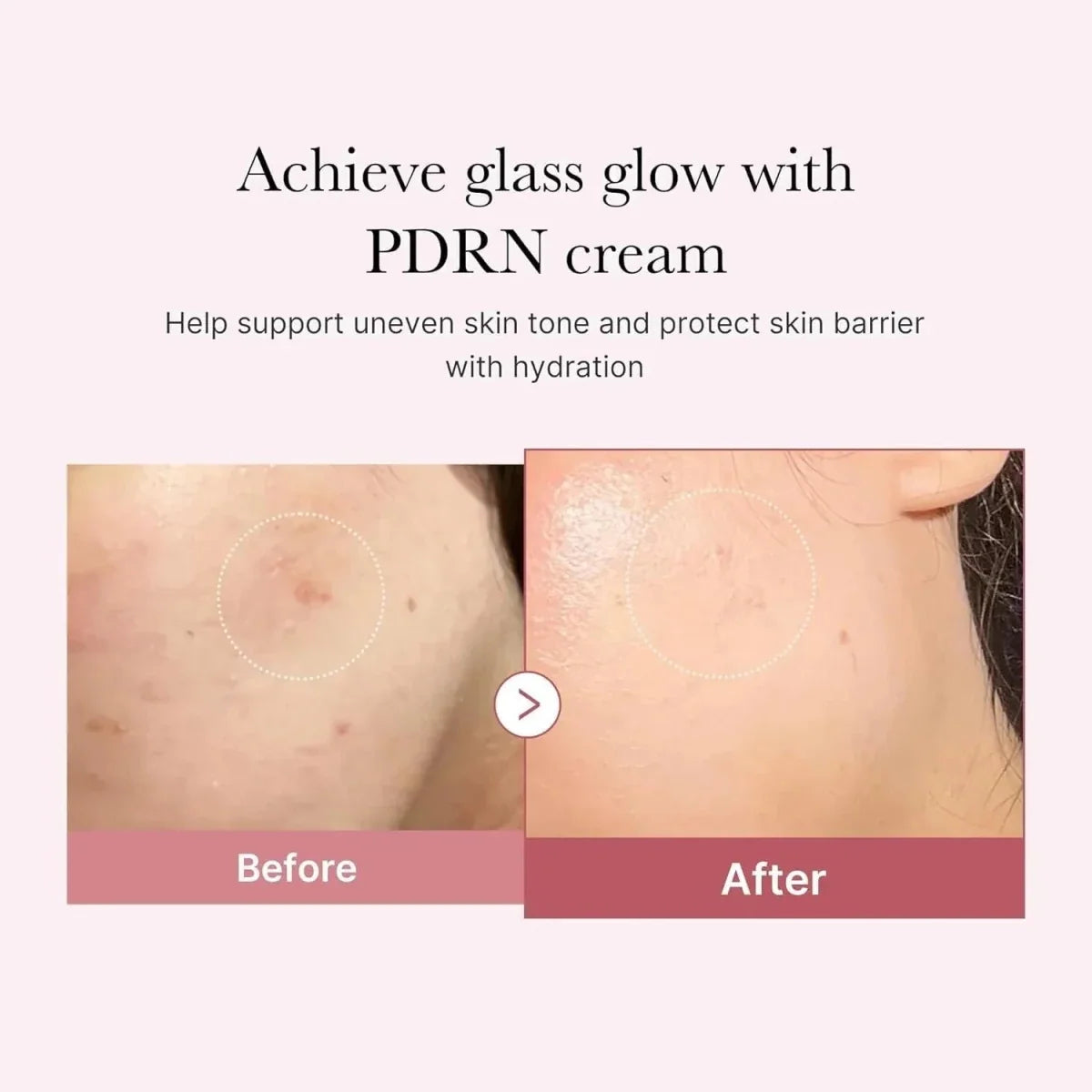 Medicube PDRN Pink Hyaluronic Moisturizing Cream 50ml
