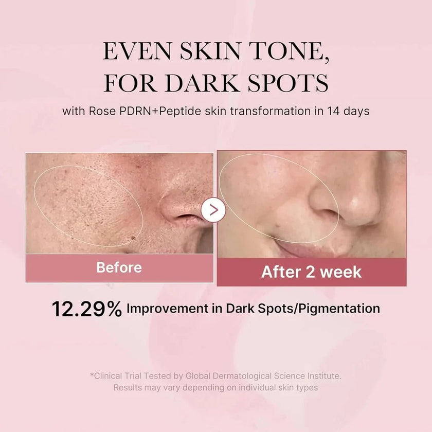 Medicube PDRN Pink Niacinamide Milky Toner 150ml