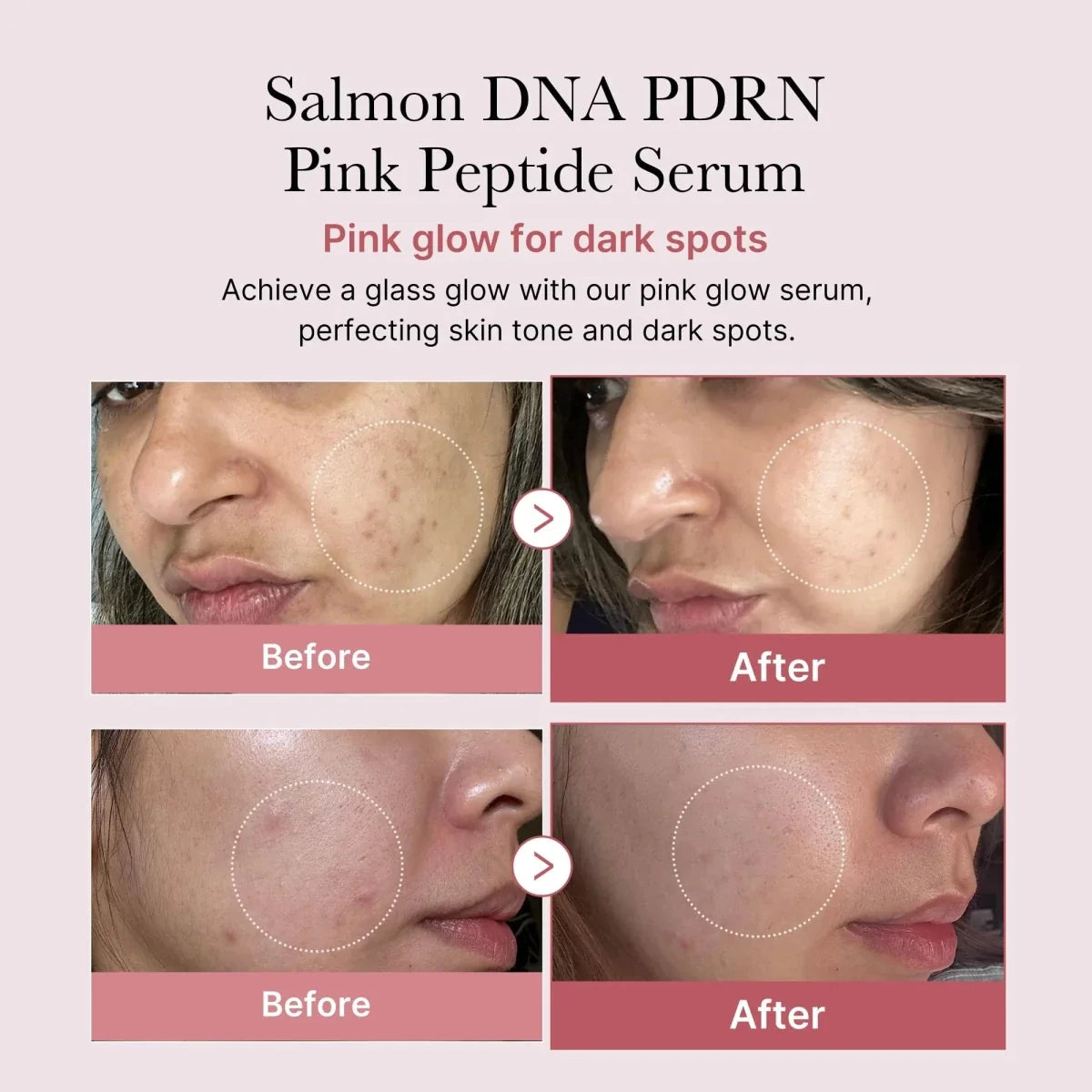 Medicube PDRN Pink One Day Serum Set 1.5mlx10