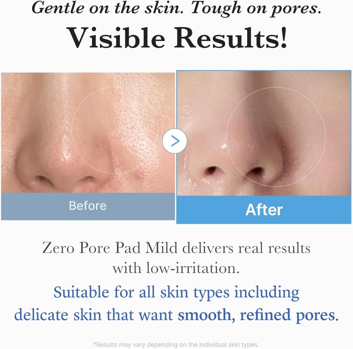 Medicube Zero Pore Pad 155g / 70 pads