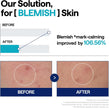 Mediheal Madecassoside Blemish Serum 40ml
