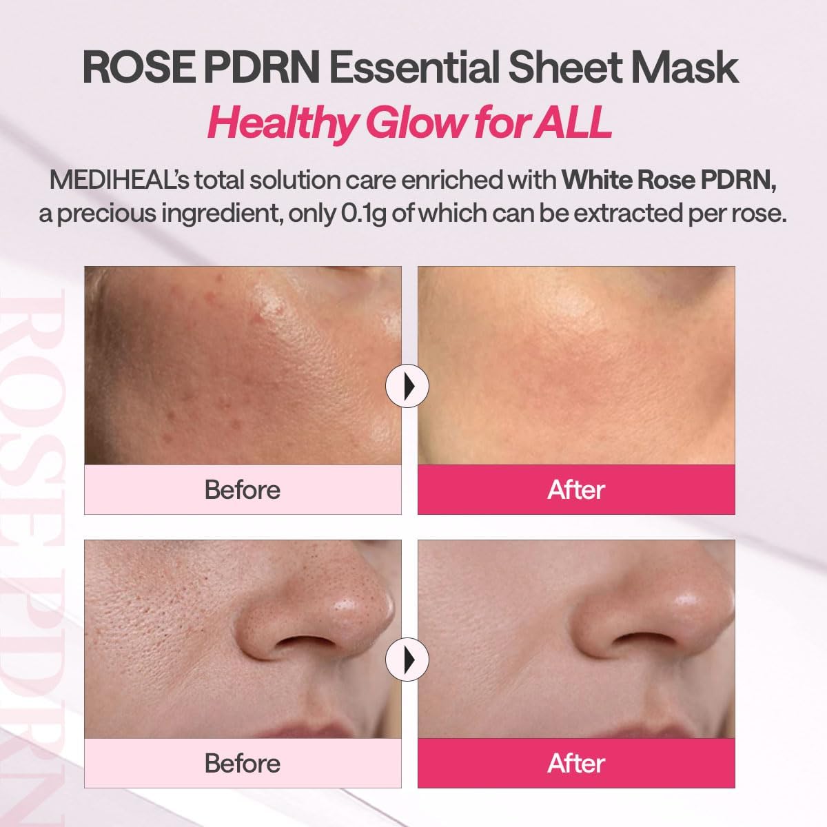 Mediheal Rose PDRN Essential Mask_Healthy Glow 24ml