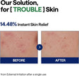 Mediheal Teatree Calming Hydra Serum 40ml