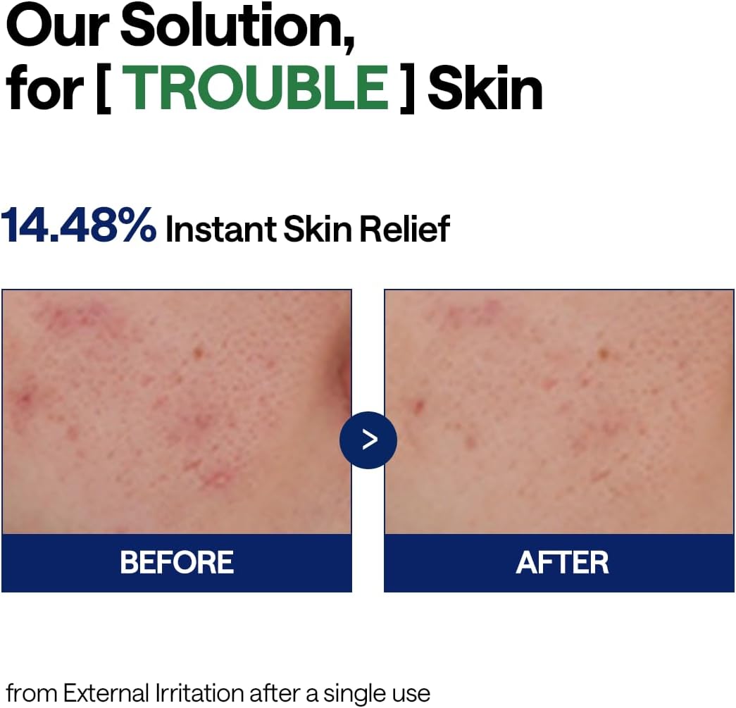 Mediheal Teatree Calming Hydra Serum 40ml