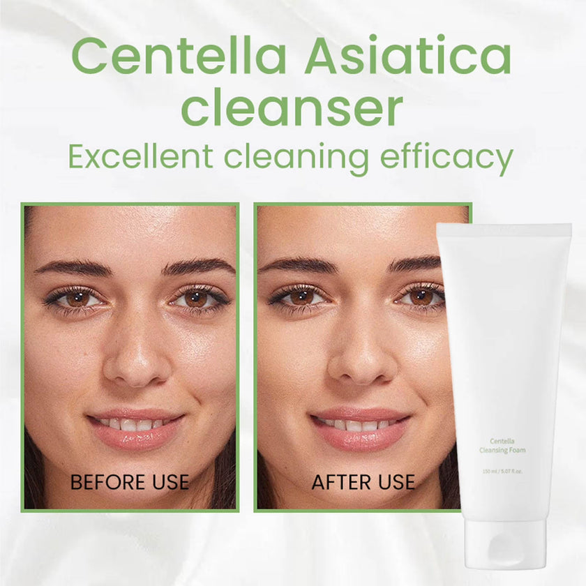 Mixsoon Centella Cleansing Foam 150ml