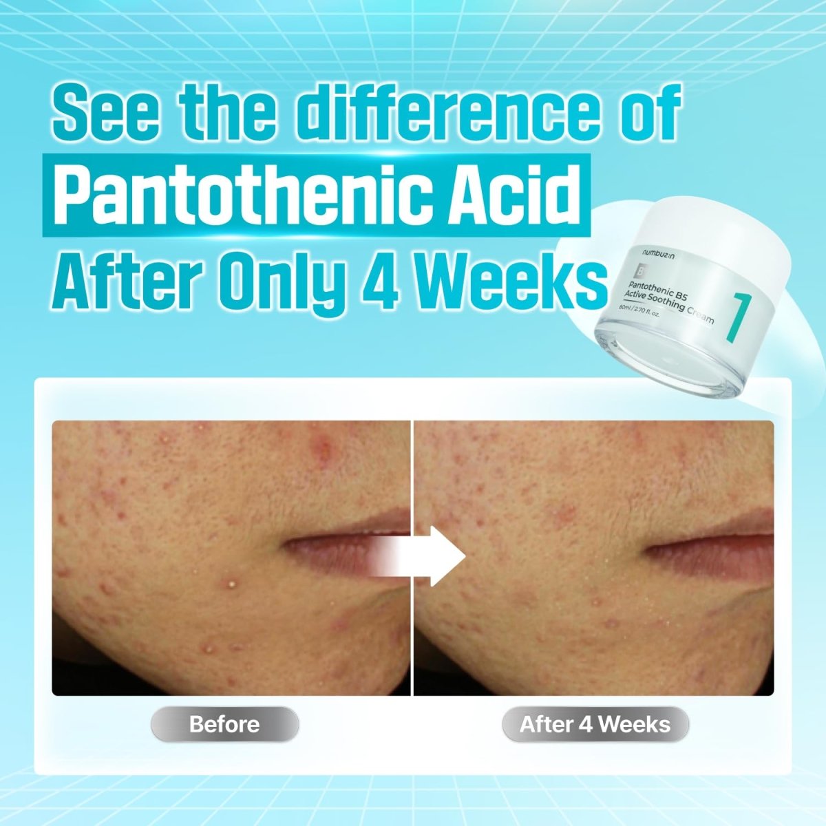 Numbuzin No.1 Pantothenic B5 Active Soothing Cream 80ml