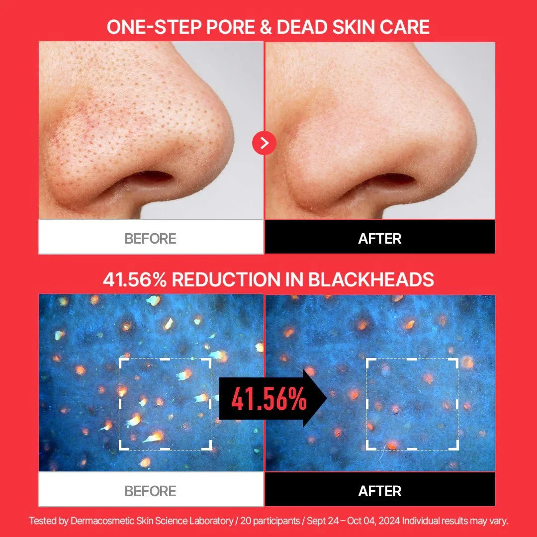 Parnell AHA Omija Ceramic Bubble Peeling Cleanser 180ml