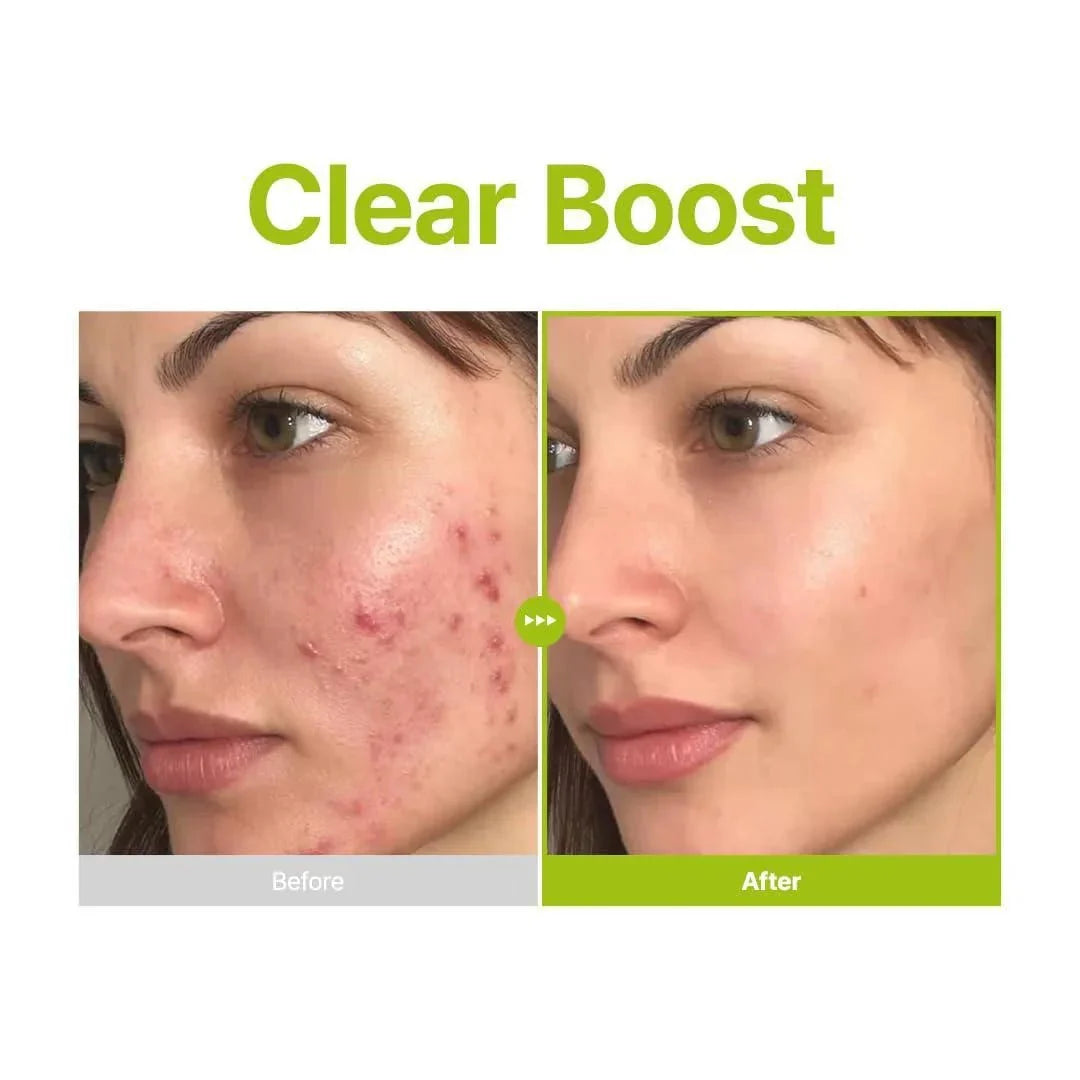 Purito Azelaic Acid 10 Kojic Tea Tree Serum 30ml