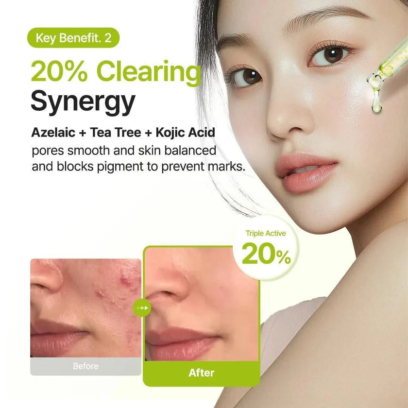 Purito Azelaic Acid 10 Kojic Tea Tree Serum 30ml