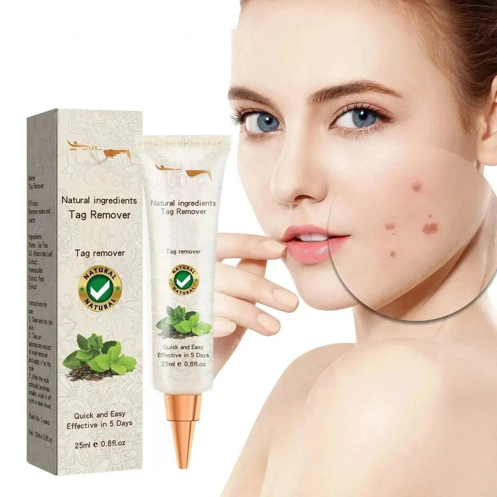 Wart Removal - Skin Cleansing Black Mole Wart Ointment Hand & Foot And Face