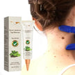 Wart Removal - Skin Cleansing Black Mole Wart Ointment Hand & Foot And Face
