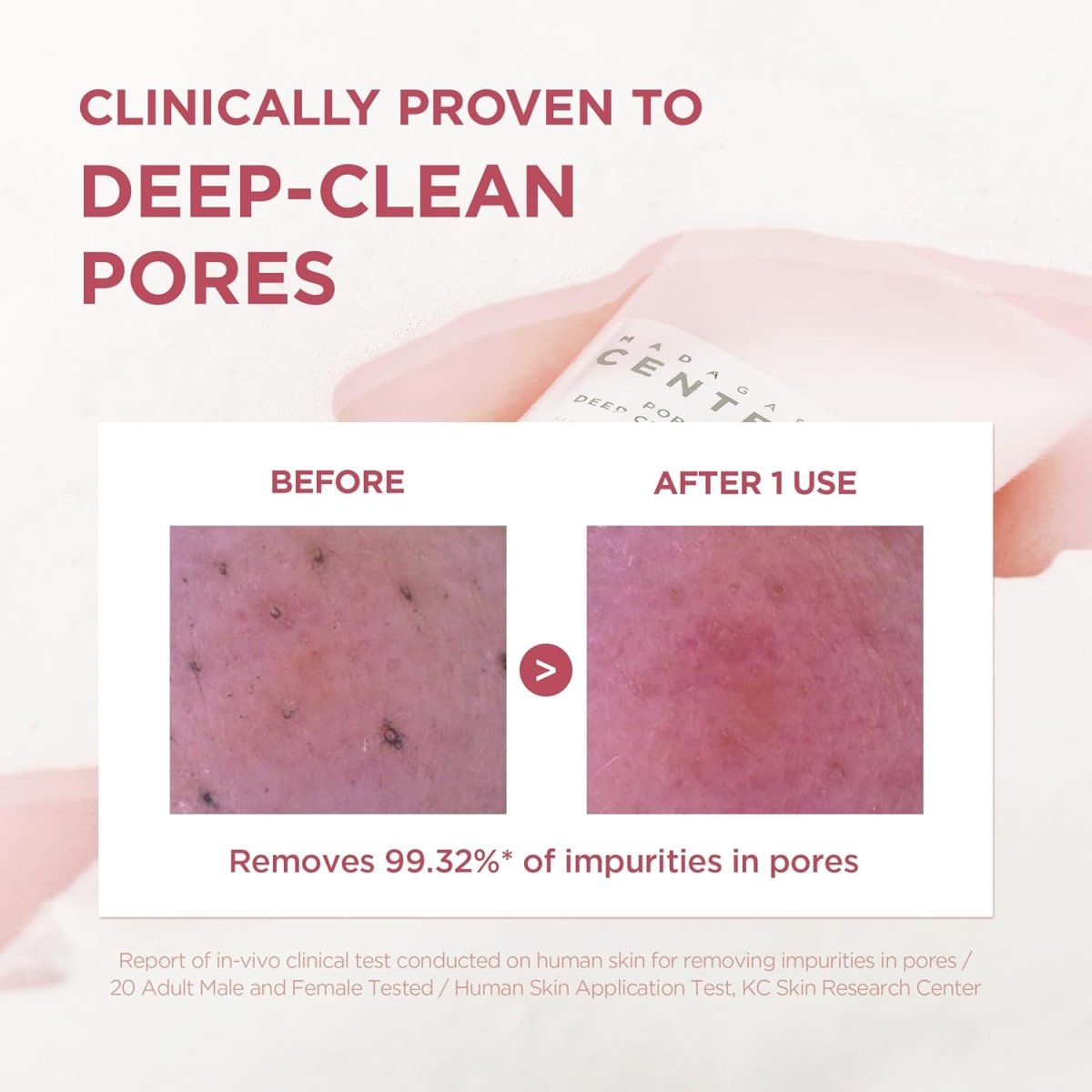 SKIN1004 Madagascar Centella Poremizing Deep Cleansing Foam 125ml