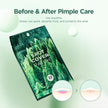 SKIN1004 Spot Cover Patch 22pcs