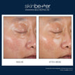 SkinBetter Science - A-Team Duo Kit