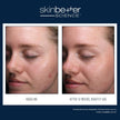 Skinbetter Science - AlphaRet Clearing Serum