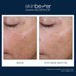 Skinbetter Science - AlphaRet Overnight Cream