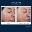 Skinbetter Science - Alto Advanced Defense and Repair