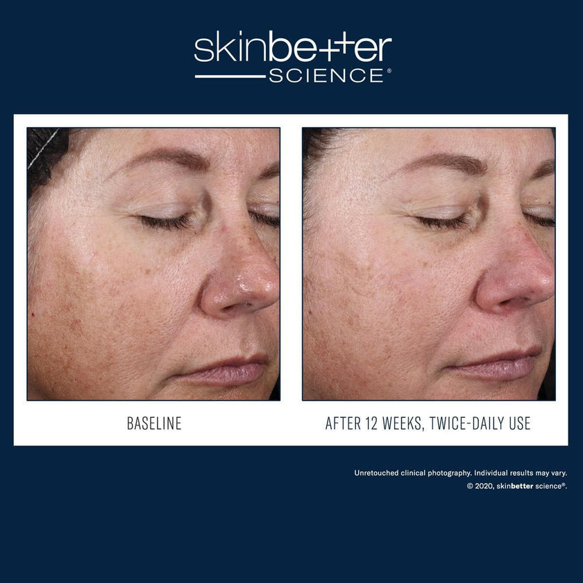 Skinbetter Science - Alto Advanced Defense and Repair