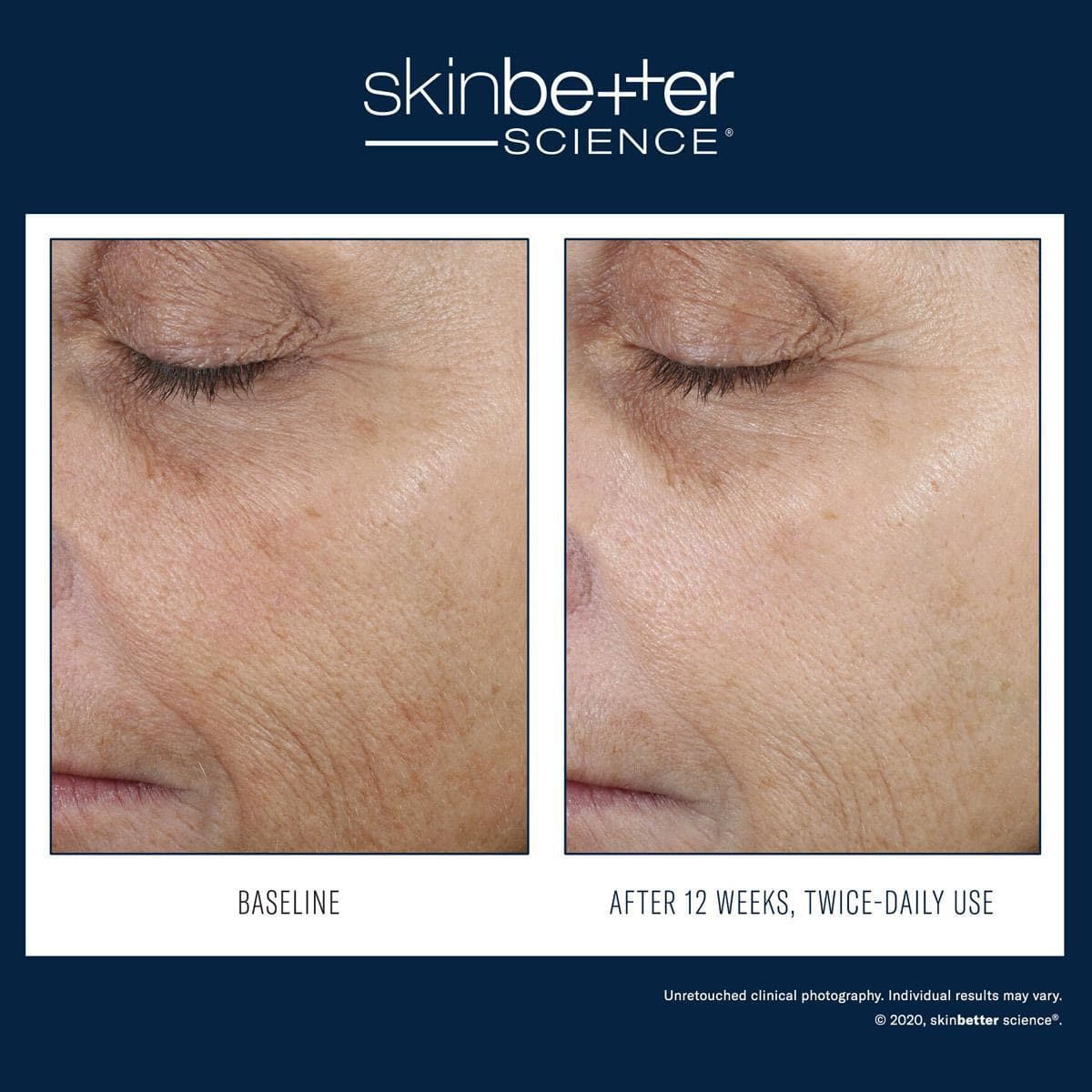 Skinbetter Science - Even Intensive Correcting Serum Face