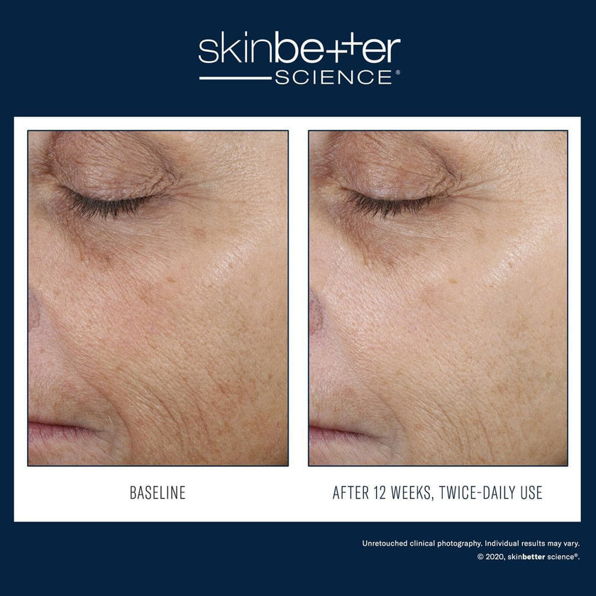 Skinbetter Science - Even Intensive Correcting Serum Face