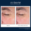 Skinbetter Science - EyeMax AlphaRet Overnight