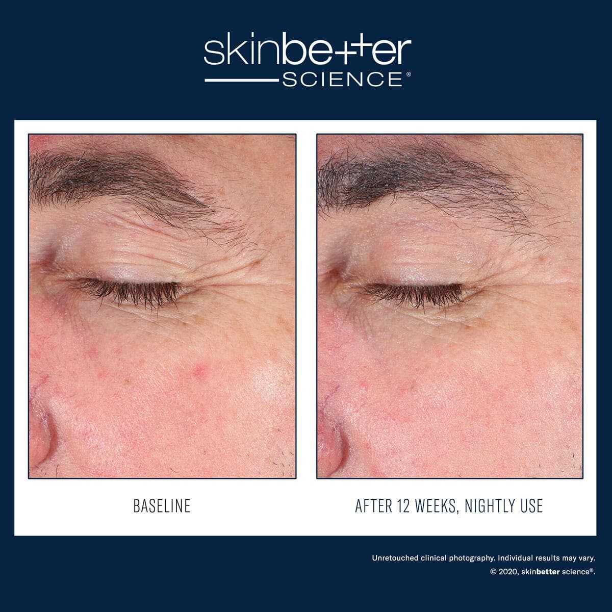 Skinbetter Science - EyeMax AlphaRet Overnight
